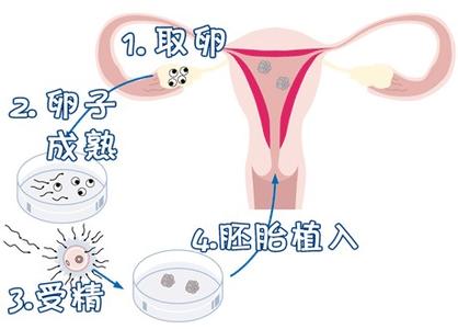 遗传咨询科